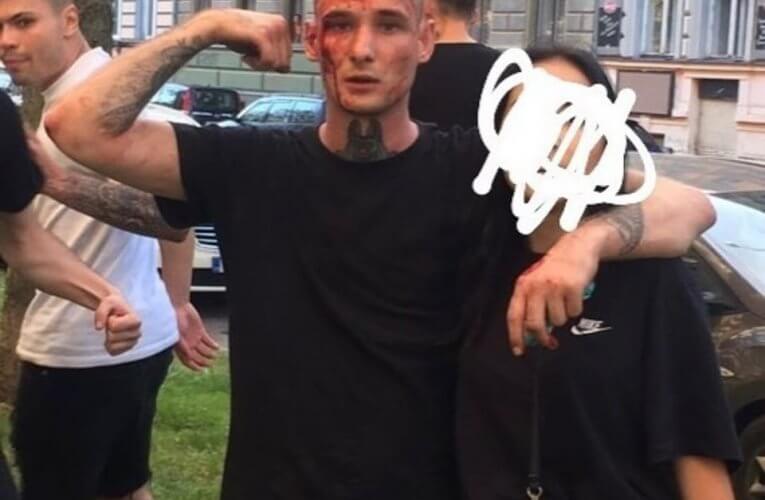 Potyčku v Žižkově ulici řeší českobudějovičtí policisté